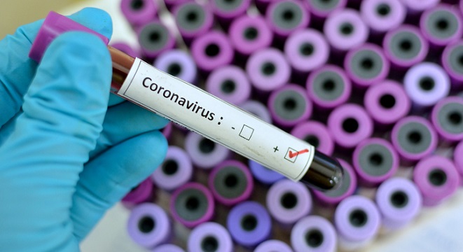کرونا ویروس چیست؟