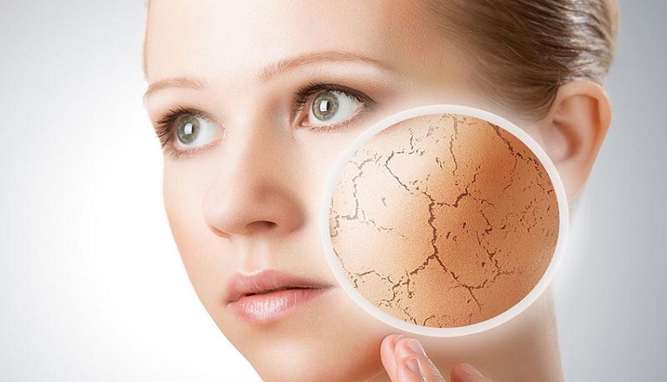 راه های تشخیص و درمان سریع خشکی پوست صورت و بدن