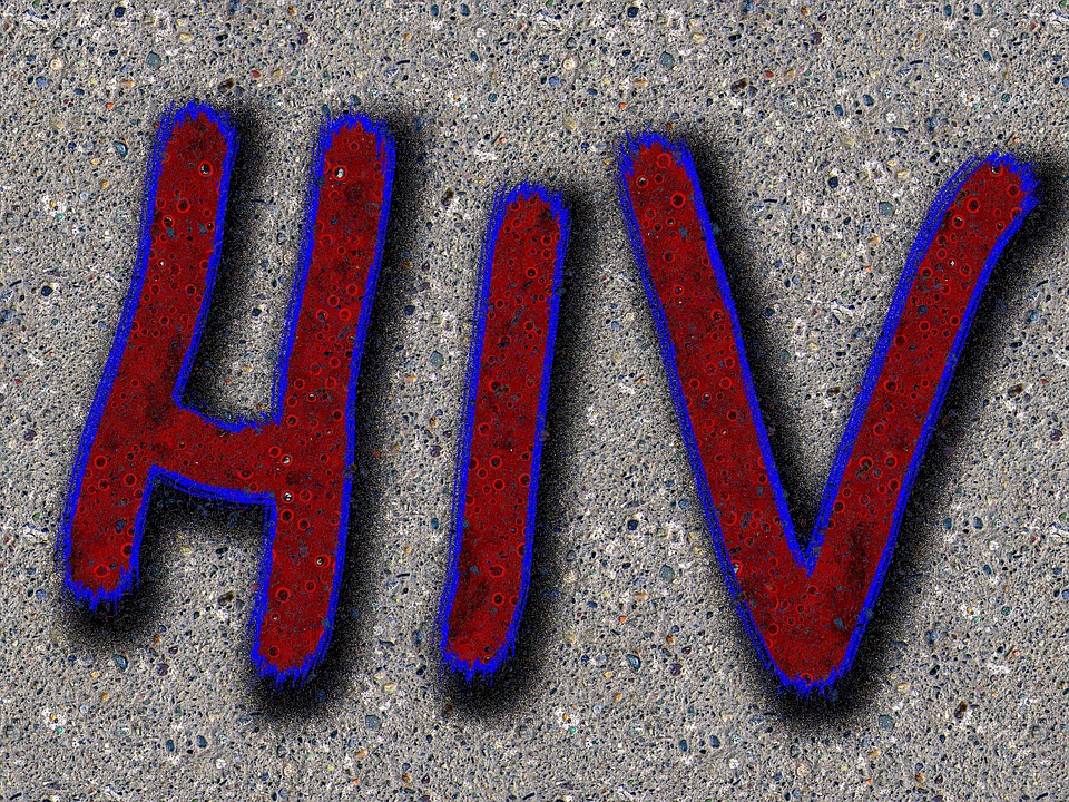 عفونت HIV