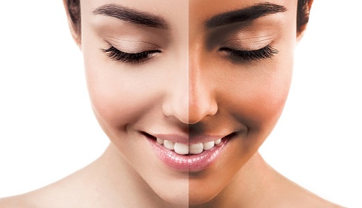 سفید کردن پوست برنزه | 8 ماسک خانگی برای روشن کردن پوست پس از برنزه شدن