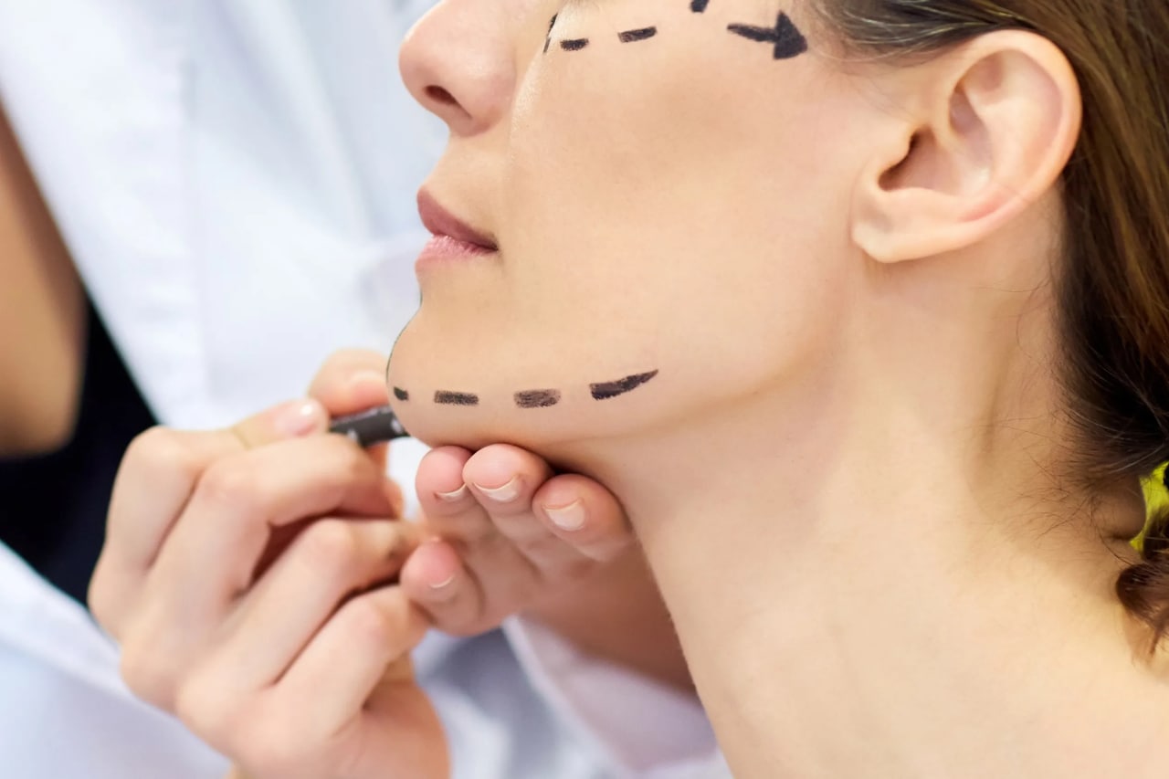آشنایی با لیفت صورت؛ جراحی و آرایش، دو راه برای کشیدن پوست