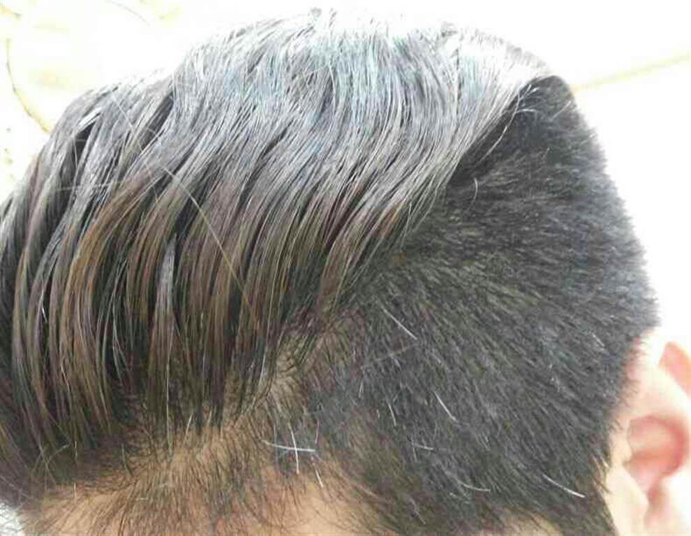 خاکستری شدن مو