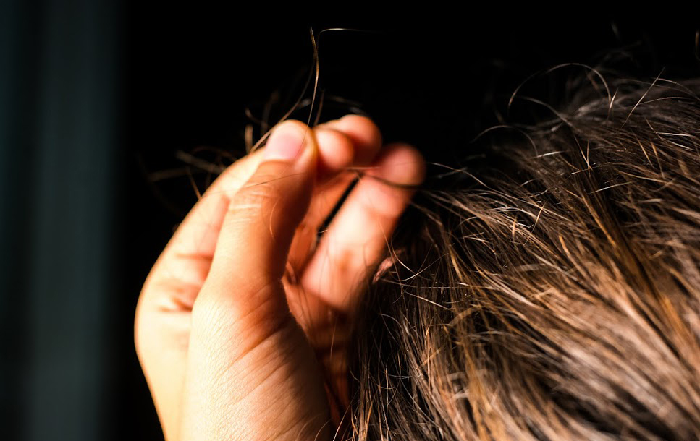 اختلال کندن مو در مردان
