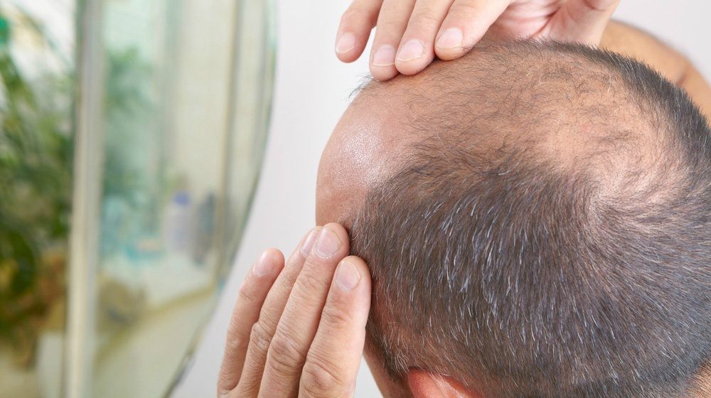 فولیکول مو چیست و چه نقشی در رشد و ترمیم مو ایفا می کند؟