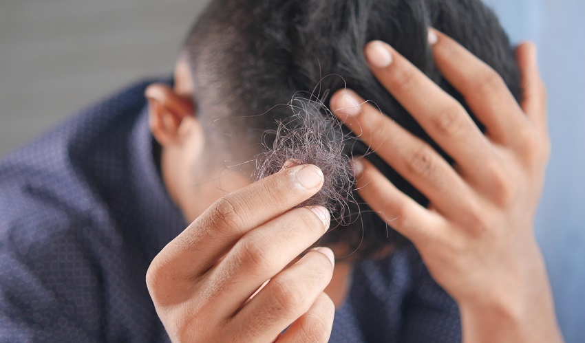3 روش درمان ریزش مو در طب سنتی؛ چطور با درمان گیاهی جلوی ریزش مو را بگیریم؟